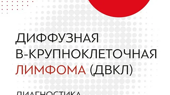 Диффузная В-крупноклеточная лимфома (ДВКЛ). Диагностика. Евгений Звонков.