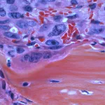 Related article thumbnail