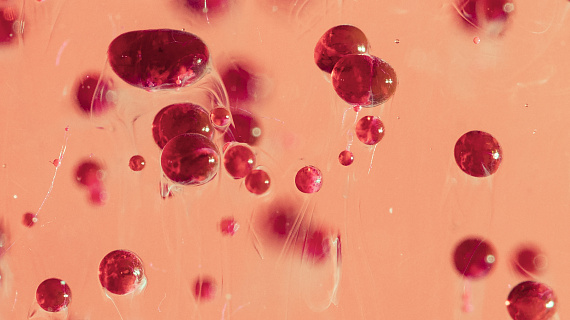 Апластическая анемия